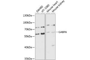Western blot analysis of extracts of various cell lines, using GABPA antibody (ABIN6127940, ABIN6140889, ABIN6140892 and ABIN6224475) at 1:1000 dilution.