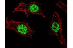 Fluorescent confocal image of HeLa cells stained with (ABIN389189 and ABIN2839352) KLF4 antibody.