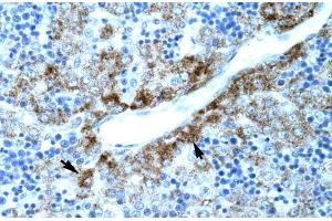 Human Liver; SLC30A9 antibody - N-terminal region in Human Liver cells using Immunohistochemistry (SLC30A9 anticorps  (N-Term))