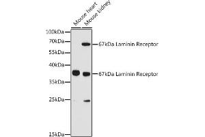 Western blot analysis of extracts of various cell lines, using 67 kDa Laminin Receptor antibody (ABIN6128199, ABIN6147247, ABIN6147248 and ABIN6224857) at 1:3000 dilution.