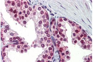 Human Prostate (formalin-fixed, paraffin-embedded) stained with UBQLN1 antibody ABIN462260 followed by biotinylated goat anti-rabbit IgG secondary antibody ABIN481713, alkaline phosphatase-streptavidin and chromogen.