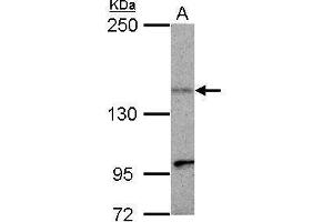 WB Image Sample (30 ug of whole cell lysate) A: HepG2 5% SDS PAGE antibody diluted at 1:500 (KIF1C anticorps)