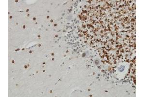 Image no. 2 for anti-Nucleoprotein TPR (TPR) (AA 1-99) antibody (ABIN598986) (TPR anticorps  (AA 1-99))