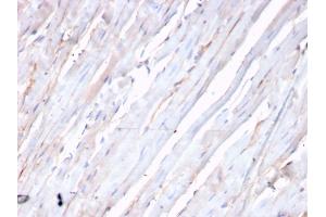Formalin-fixed, paraffin-embedded human heart stained with N-Cadherin Recombinant Rabbit Monoclonal Antibody (CDH2/3874R).