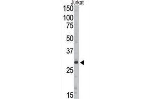 Western Blotting (WB) image for anti-Sirtuin 5 (SIRT5) antibody (ABIN3002566)