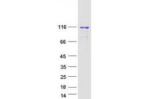 Validation with Western Blot