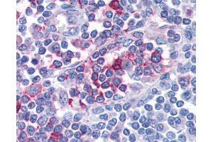 Anti-FPR1 antibody IHC of human lymph node.