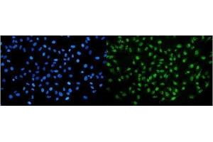 IF analysis of NIRF using anti-NIRF antibody (ABIN7603150).
