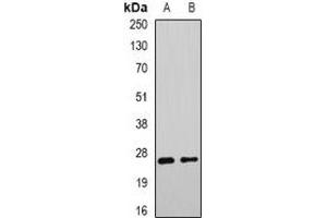 Western blot analysis of DNAJB9 expression in mouse liver (A), rat liver (B) whole cell lysates. (DNAJB9 anticorps)