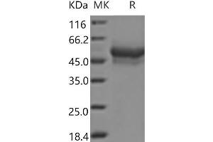 Western Blotting (WB) image for Lymphocyte-Activation Gene 3 (LAG3) protein (His tag) (ABIN7321105) (LAG3 Protein (His tag))