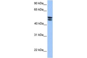 Western Blotting (WB) image for anti-3-Oxoacid CoA Transferase 1 (OXCT1) antibody (ABIN2463188) (OXCT1 anticorps)