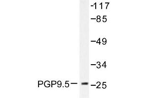 Image no. 2 for anti-Ubiquitin Carboxyl-terminal Esterase L1 (Ubiquitin Thiolesterase) (UCHL1) antibody (ABIN271784) (UCHL1 anticorps)