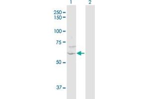 Western Blot analysis of ZNF238 expression in transfected 293T cell line by ZNF238 MaxPab polyclonal antibody. (ZNF238 anticorps  (AA 1-522))