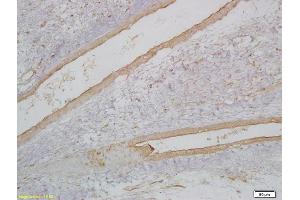 Formalin-fixed and paraffin embedded embryonic rhabdomyoma labeled with Anti-MyoD1/Myf3 Polyclonal Antibody, Unconjugated (ABIN740340) at 1:200 followed by conjugation to the secondary antibody