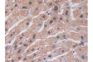 Detection of ALT in Human Liver Tissue using Polyclonal Antibody to Alanine Aminotransferase (ALT)