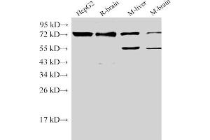 Western Blot analysis of 1)HepG2, 2)Rat brain, 3)Mouse liver, 4)Mouse brain using CD146 Ployclonal Antibody at dilution of 1:500. (MCAM anticorps)