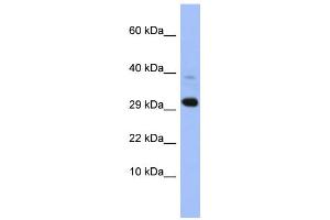 WB Suggested Anti-MRPL47 Antibody Titration: 0. (MRPL47 anticorps  (Middle Region))