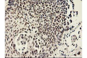 Image no. 2 for anti-General Transcription Factor IIF, Polypeptide 1, 74kDa (GTF2F1) antibody (ABIN1500597)