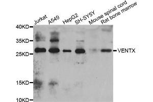 Western blot analysis of extracts of various cell lines, using VENTX antibody (ABIN5975554) at 1/1000 dilution. (VENTX anticorps)
