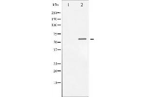 Western blot analysis of Chk1 phosphorylation expression in MCF7 whole cell lysates,The lane on the left is treated with the antigen-specific peptide. (CHEK1 anticorps  (pSer317))