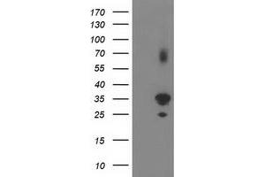 Western Blotting (WB) image for anti-Pleckstrin Homology Domain Containing Family A3 (PLEKHA3) antibody (ABIN1500273) (PLEKHA3 anticorps)