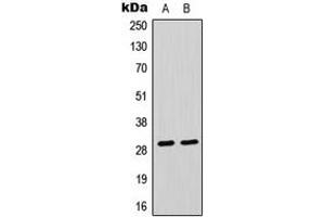 Western blot analysis of CLIC4 expression in Raji (A), HeLa (B) whole cell lysates. (CLIC4 anticorps  (N-Term))