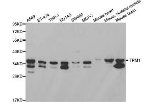 Western blot analysis of extracts of various cell lines, using TPM1 antibody (ABIN2989338) at 1/1000 dilution. (Tropomyosin anticorps)