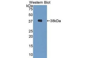 Western blot analysis of the recombinant protein. (Decorin anticorps  (AA 31-359))