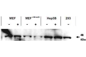 Western blot using SMAD3 polyclonal antibody  shows detection of endogenous SMAD3 in both unstimulated and stimulated cell lysates. (SMAD3 anticorps  (AA 417-425))