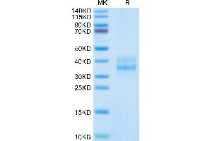 Human CDH17 Domain 1&2 on Tris-Bis PAGE under reduced condition. (LI Cadherin Protein (AA 30-244) (His tag))