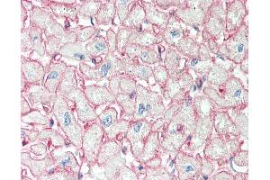 Human Heart: Formalin-Fixed, Paraffin-Embedded (FFPE).