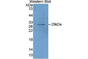 Western blot analysis of the recombinant protein. (CD25 anticorps  (AA 22-243))
