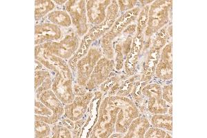 Immunohistochemistry of paraffin-embedded mouse kidney using [KO Validated]  Rabbit mAb (ABIN7271243) at dilution of 1:100 (40x lens).
