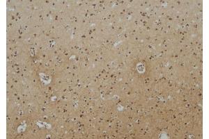 ABIN6257165 and ABIN6275114 at 1/100 staining Human brain tissue by IHC-P. (EPN3 anticorps  (Internal Region))