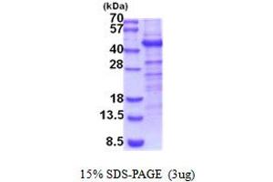 SDS-PAGE (SDS) image for Carbohydrate Sulfotransferase 10 (CHST10) (AA 28-356) protein (His tag) (ABIN5854169) (CHST10 Protein (AA 28-356) (His tag))