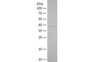 Western Blotting (WB) image for phospholipase A2, Group XIIA (PLA2G12A) (AA 24-189) protein (His-IF2DI Tag) (ABIN7124431)