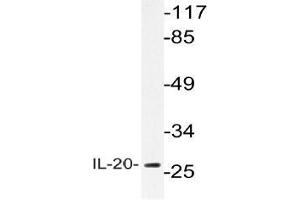 Western blot (WB) analysis of IL-20 antibody in extracts from A549 cells. (IL-20 anticorps)