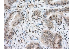 Image no. 8 for anti-Transforming, Acidic Coiled-Coil Containing Protein 3 (TACC3) antibody (ABIN1498099) (TACC3 anticorps)