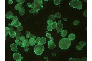 Immunofluorescence (IF) image for anti-Herpes Simplex Virus Type 1/2, Glycoprotein B (HSV1/2 gB) antibody (ABIN457436)