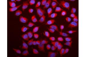 IF analysis of Caspase-9/CASP9 using anti-Caspase-9/CASP9 antibody (ABIN7601196).