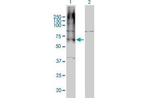 Western Blot analysis of GABBR1 expression in transfected 293T cell line by GABBR1 monoclonal antibody (M01), clone 2D7.