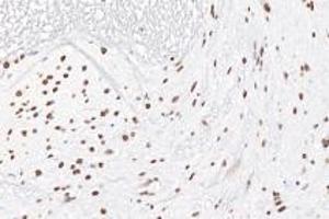 Immunohistochemistry analysis of paraffin-embedded rat spinal cord using,Ring1A (ABIN7075467) at dilution of 1: 3600