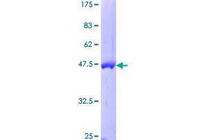 Image no. 1 for DIRAS Family, GTP-Binding RAS-Like 1 (DIRAS1) (AA 1-198) protein (GST tag) (ABIN1351617)