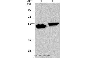 Western blot analysis of Raji and Hela cell, using AVEN Polyclonal Antibody at dilution of 1:200 (AVEN anticorps)