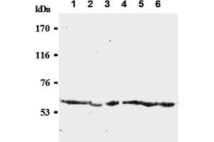 Western Blotting (WB) image for anti-Cell Division Cycle 25 Homolog C (S. Pombe) (CDC25C) antibody (ABIN487484) (CDC25C anticorps)