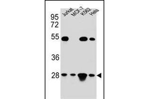 TF Antibody (C-term) (ABIN654229 and ABIN2844063) western blot analysis in Hela,Jurkat,K562,MCF-7 cell line lysates (35 μg/lane). (TFAM anticorps  (C-Term))