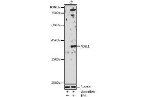 Western blot analysis of extracts of C6 cells, using FOSL1 antibody (ABIN6131653, ABIN6140738, ABIN6140739 and ABIN6221016) at 1:1000 dilution. (FOSL1 anticorps  (AA 1-100))