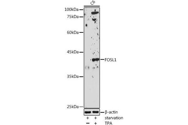 FOSL1 antibody  (AA 1-100)