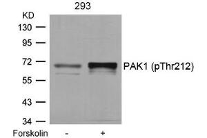 Western blot analysis of extracts from 293 cells untreated or treated with forskolin using PAK1(Phospho-Thr212) Antibody. (PAK1 anticorps  (pThr212))