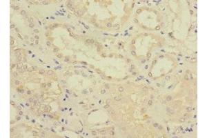 Immunohistochemistry of paraffin-embedded human kidney tissue using ABIN7153109 at dilution of 1:100 (FTCD anticorps  (AA 412-541))